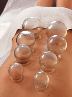 cupping on a back