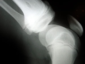 radiograph of knee